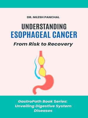 cover image of Understanding Esophageal Cancer